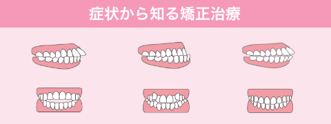 歯並びの症状から知る歯科矯正治療