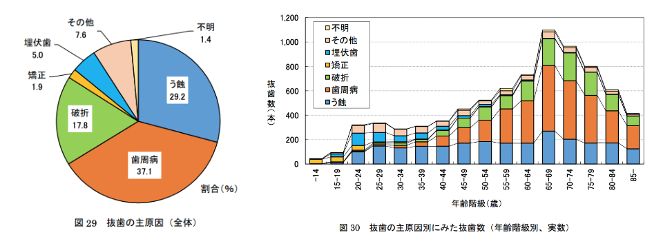 むし歯、歯周病の説明