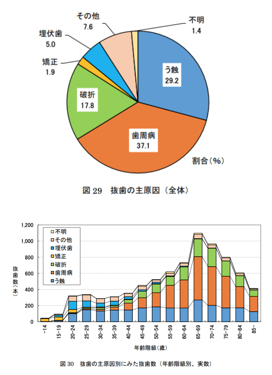 むし歯、歯周病の説明