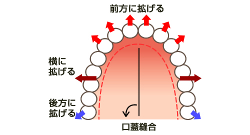 拡大矯正の際の注意点